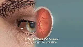 Revitalize Your Vision with Saffron Eye Supplements! 👁️✨