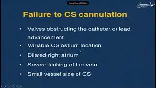 CRT Implantation   Dr  Mohamed Nabil