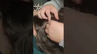 Asmr Scalp Check #dandruffscratching #nitpicking #hairplay #asmrsleep