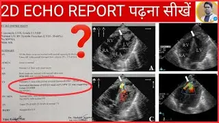 2D ECHO REPORT कैसे पढ़ते हैं/2D ECHO REPORT मैं क्या क्या लिखा होता है/2D ECHO दिल की जांच रिपोर्ट