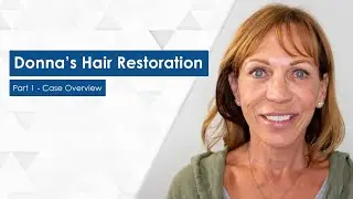 Donna's Hair Transplant Journey - Part 1 - Case Overview