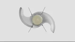 Cuisinart recalling 8 million food processors