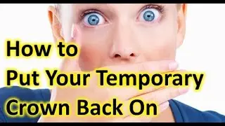 What to do if my Temporary Crown Fell Off *How to Cement your Crown that Fell Out or Came Off