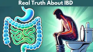 The Shocking TRUTH About IBD That's Ruining Your Life!