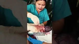 Episiotomy (widening the birth canal) in the Myanmar jungle