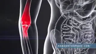 Common Hand Traumas - STEVEN S. SHIN, MD, MMS