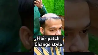 hair patch taping method, 9354535308 #shorts #trending #hairlosstreatment
