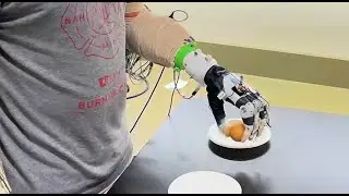 Shared human-machine control of an intelligent bionic hand