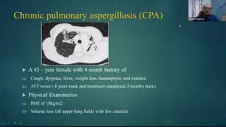 Fungal Infections in Lungs