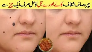 1 Home Remedy for All, Black Spots, Pigmentation, Brown Spots, Moles, Discoloration Urdu Hindi