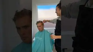 Bald at 23 Pt. 2 #hairstyle #turkey