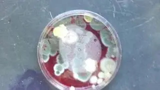 Penicillium, dermatophytes, micoconidia, macroconidia, hyphae, conidia, phialides