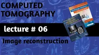 #image reconstruction/filter back projection/Fourier transformation/convolution/CT/Radiology