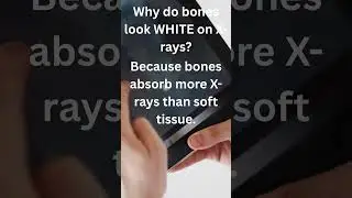 Why do bones look white on X-rays? 🦴🩻