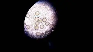 Taenia (tapeworm) eggs under microscope