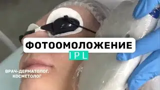 Фотоомоложение  IPL