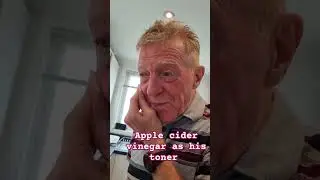Apple cider vinegar as his toner #shirts #shortsvideo #applecidervinegar #toner #face #cleanser