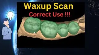 Correct use of WAXUP Scan (Exocad Tutorial)