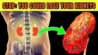 CAREFUL! 12 BAD Habits That Damage Your KIDNEYS