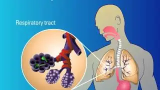 Recognition of Fungi and Activation of Immune Response