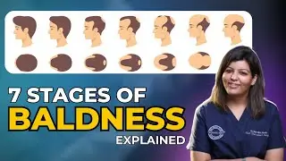 Understanding Hair Loss Stages: A Comprehensive Guide to Scalp Assessment and Treatment Options