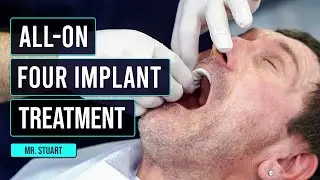 All-on-4 Implant Procedure: Watch Stuart's Transformative Journey to a New Smile in Turkey