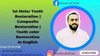 1st Molar Restoration | Composite Restoration | Tooth Color Restoration ( Filling) Clinical Demo