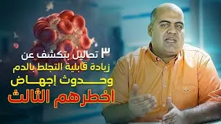 تحاليل الكشف عن زيادة قابلية التجلطات | Protein C & S و AT III والهوموسيستين| د. أحمد رضوان الأنصارى