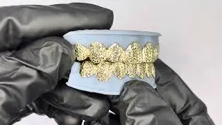 Top 8 and Bottom 8 Diamond Cut Custom Grillz in Yellow Gold