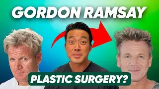 The TRUTH About Gordon Ramsay's New Face Revealed