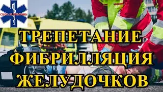 Трепетание и фибрилляция желудочков