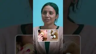 Laser Expert Shares Shocking Truth About Post Acne Scars & PIH Treatment
