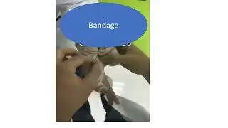 bandage for arm and thumb/ 👉 ضماد للذراع والإبهام