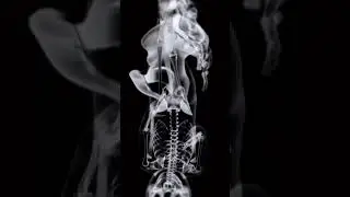 3d structure baby birth
