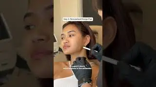 Cheap Botox = Fake? Not with us! 💉✨#medspa #mesomedspa #Botox