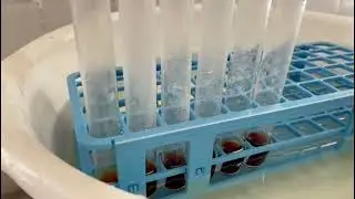 TP1-3  Biochimie : Détermination de la vitesse initiale d'une réaction enzymatique