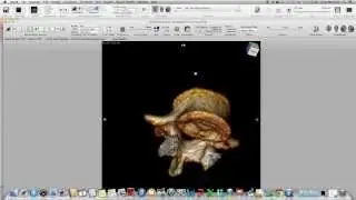 Spine FEA Tutorial in Abaqus - Pt. 3 - Surface Model Generation