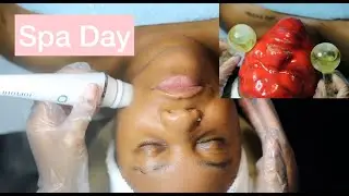 Vampire PLLA Hydrojelly Mask + Extractions by Curve Creations Esthetics, Texas