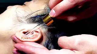 Satisfying Ear Massage ASMR 👂😌 Sleep 💤 #asmr #satisfying #massage #sleep #youtube #relaxing
