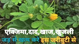 पुरानी दाद,खाज,खुजली,एक्जिमा जड़ से खत्म करे। Benifits of Chakramard।चर्म रोग की दवा।