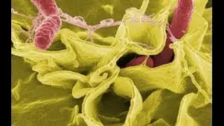 Bacteria friend and foe -