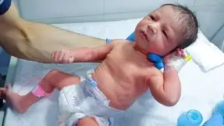 IUGR Baby in NICU | Treatment, Nursing Care, and First Feeding Trial#hospitalcare#neonatologist 