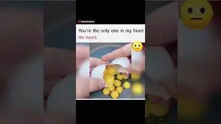 True Love, Funny Video 😲😜 | #shorts #funny