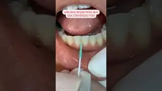 Dica para quem usa conten&ccedil;&atilde;o fixa