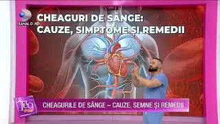Teo Show (24.03.2021) - Cheguri de sande - cauze, semne si remedii!