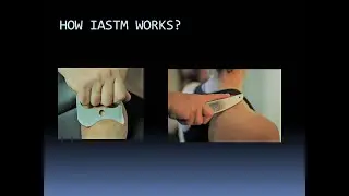 WHAT IS IASTM technique(Instrument Assisted Soft Tissue Mobilization)? How does it work?