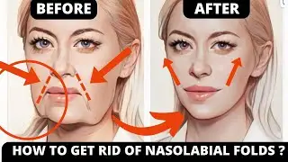 No Botox! Face Yoga for Laugh Lines & Jowls!  Frown Lines & Smile Wrinkles