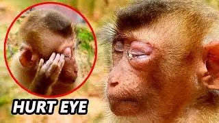 HURT AND WORRY LEFT EYE...!! Monkey SOK can't open hurt & Itching \ Pity Sok not see....