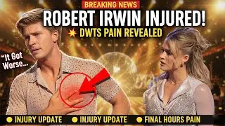 Robert Irwin Reveals Painful Rib Injury Right After DWTS Win &mdash; &lsquo;It Got Worse Every Day&rsquo;
