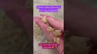#feet #feets #pedicure #callusremoval #callus #goddess #asmr #vasmr